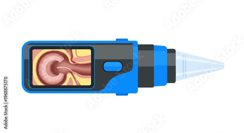 Medical device, endoscopy tool, blue medical equipment, health technology