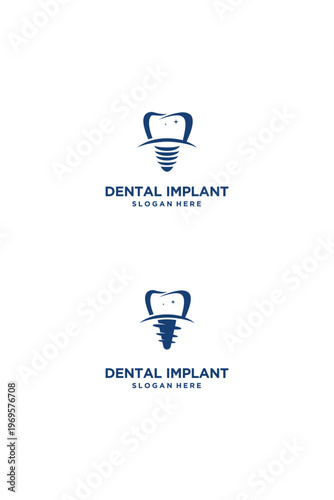 Dental Implant Logo Design Modern and Professional Concept 1.