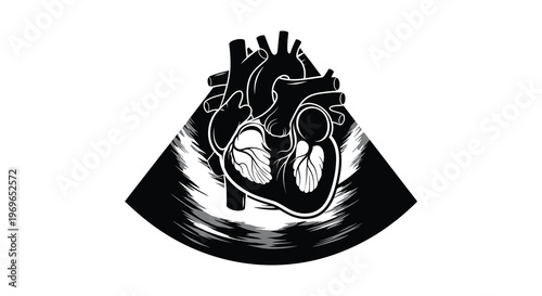 Anatomical heart illustration with vascular structures presented as a silhouette