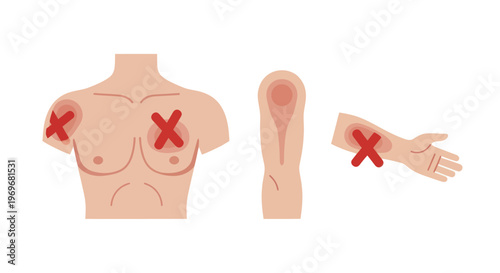 Human body parts with red crosses indicating pain or injury.