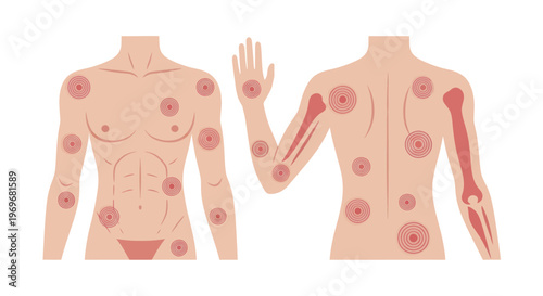 Human body with various skin and joint conditions illustration.