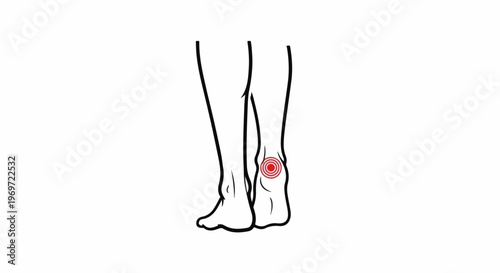 Line art of lower legs with a red pain indicator on the right ankle