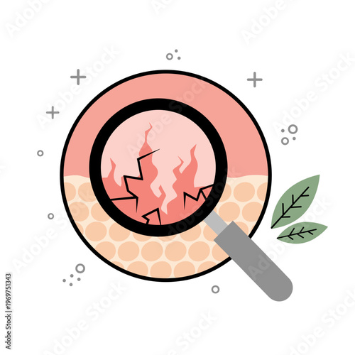 Flat Vector Illustration of Eczema Skin Under Magnifying Glass