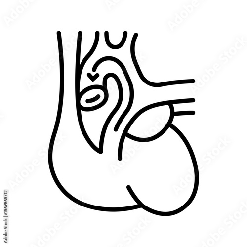 Heart defect icon. Healthcare and cardiology line symbol. Black and white.