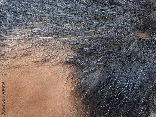 Extreme Close-up of Human Scalp with Short Black and Graying Hair Texture
