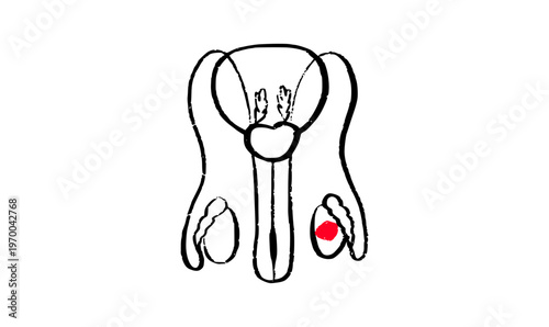 Testicular pathologies concept