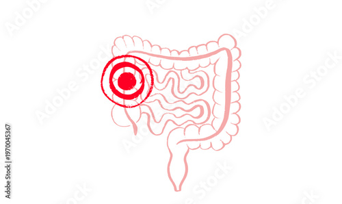 Intestine diseases sketch