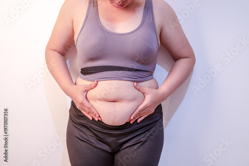 Quadro su tela Overweight fat woman with visceral belly fat, grabbing skin on her excessive fat