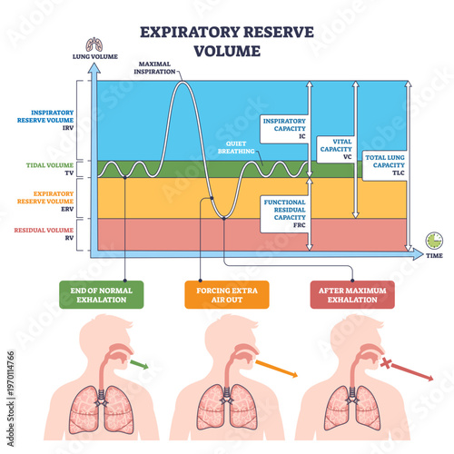 Expiratory reserve volume illustrated, spirometry graph with lungs and arrows shows extra air exhaled after normal breath and how ERV fits among lung capacities, transparent background.
