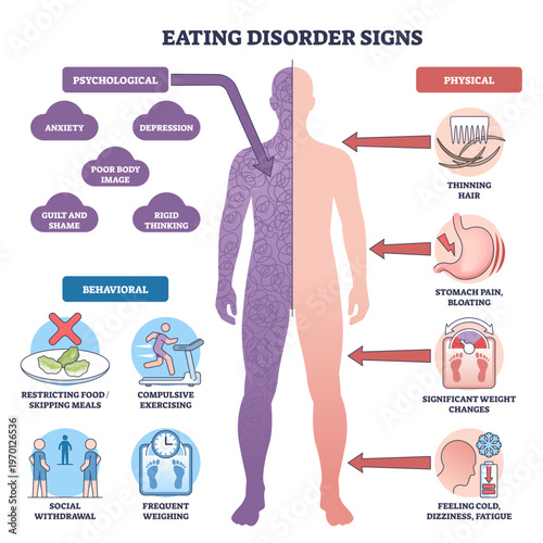 Eating disorder signs brief outline depicts a split human figure with labels and arrows highlighting psychological, behavioral, and physical symptoms, transparent background.