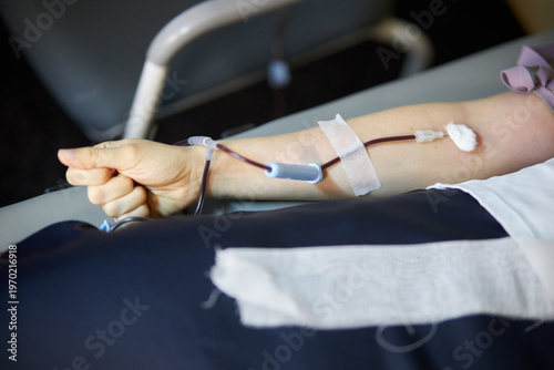 Blood donation concept. A donor gives blood. A close-up of a hand with a small blood bag attached during a blood donation. Donating blood for the military.