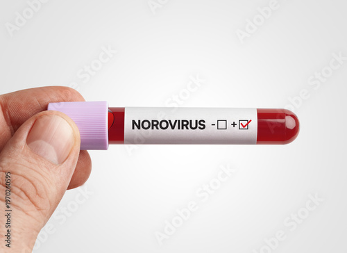 A scientist holds a test tube labeled “Norovirus” symbolizing the detection and study of a highly contagious viral pathogen in a controlled laboratory setting. 