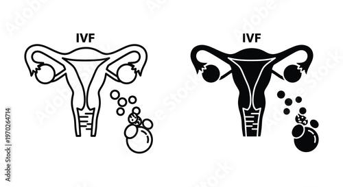 Illustrative diagram of a female reproductive system and in vitro fertilization silhouette