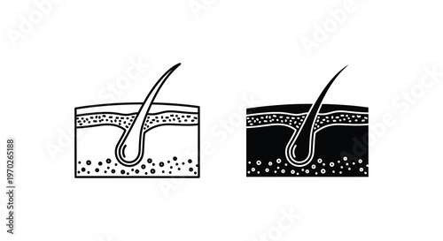 Diagram of human hair follicle structure cross section view black and white silhouette