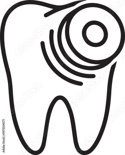 Professional porcelain veneer polishing process with high-speed buffing wheel for dental restorative treatments, cosmetic dentistry workflows, and dental lab precision applications—ideal