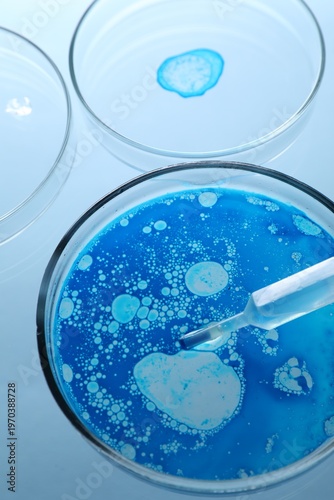 Petri dishes and pipette with liquid samples on light blue background, closeup