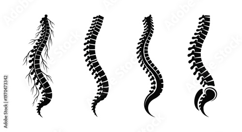 Four spinal columns shown in varying degrees of curvature silhouette