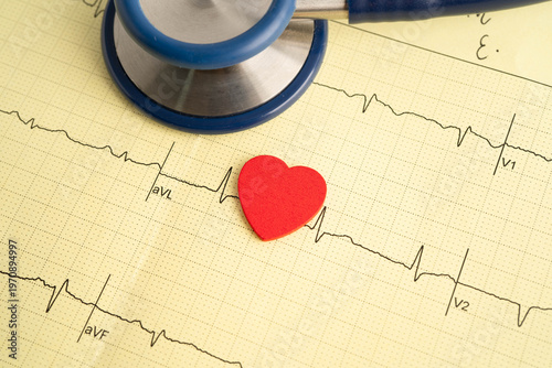 Stethoscope on electrocardiogram ECG, heart wave, heart attack, cardiogram report.