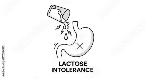 Lactose intolerance concept with stomach icon and milk pouring from a glass. Healthcare illustration of digestive system problems and food allergy symptoms