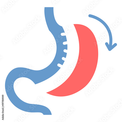 Bariatric Surgery Vector Icon