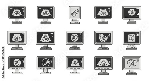 Collection of monochrome ultrasound scans displaying fetal development on monitors, representing medical imaging and pregnancy monitoring.