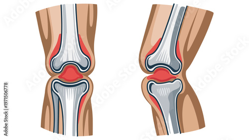 Detailed medical diagrams showcasing the healthy anatomy of a human knee joint from frontal and sagittal views.