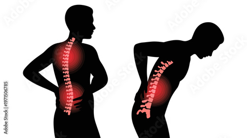 Silhouettes of people experiencing back pain, highlighting the spine in both upright and bent postures.