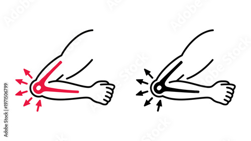 Detailed anatomical diagrams comparing an elbow joint with pain and a healthy elbow joint.