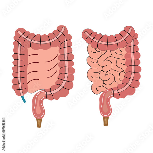 Gas and bloating vector illustration