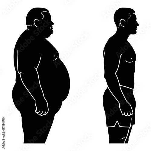 Comparison of body types between obesity and normal weight Vector, illustration