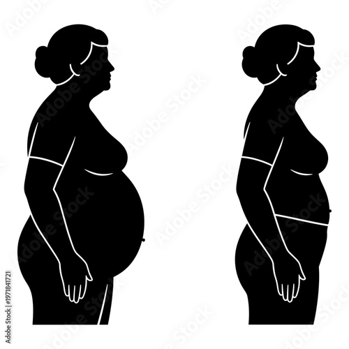 Silhouettes of pregnant woman showing different stages of belly growth from the side view Vector, illustration
