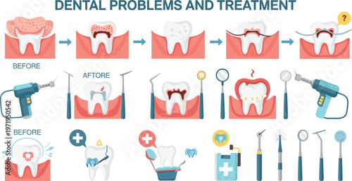 Dental Problems and Treatment Illustration with Tooth Decay Stages, Before and After Care, Dentist Tools and Oral Health Procedure Guide