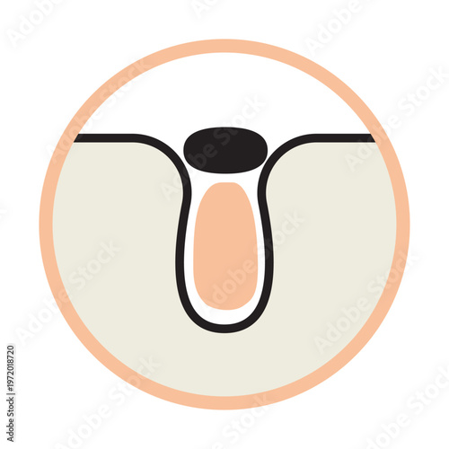 黒ずみ毛穴を表す皮膚断面アイコン（角栓・皮脂）