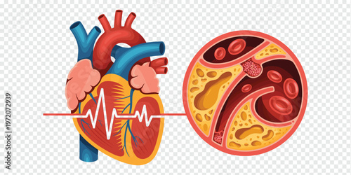 Human Heart Clogged Artery Medical Health Concept