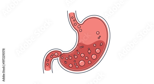 Medical illustration of the human stomach showing the digestive process with acid and bubbles during food breakdown.