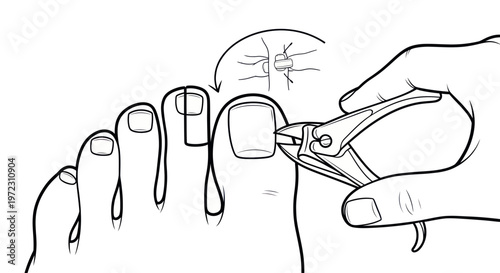 Close-up of foot with toenail clippers trimming a nail, hygiene concept
