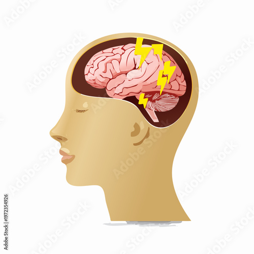 Profile of a woman's head with a detailed brain and lightning bolts. mental health concept with lightning bolt