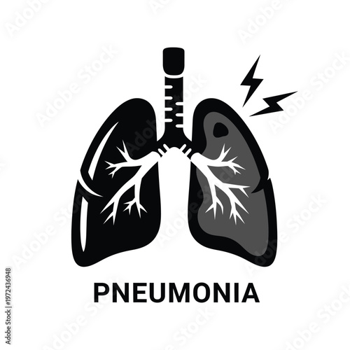 A graphic illustration depicts human lungs with one lung highlighted to signify pneumonia and pain high quality