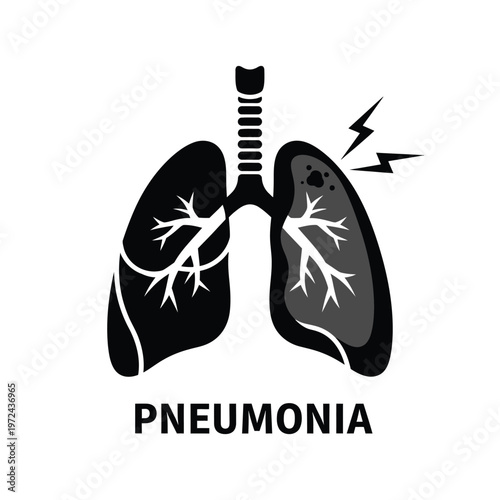 A graphic illustration depicts damaged lungs with inflammation and lightning bolts labeling the condition pneumonia high quality