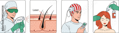 Laser Hair Removal Procedure Illustration Set with Skin Hair Follicle Laser Therapy and Hair Treatment Vector
