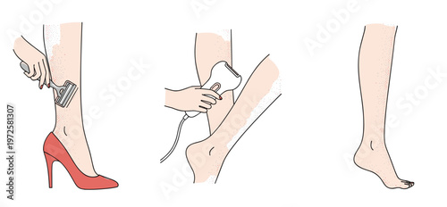 Leg Hair Removal Methods Illustration Set with Razor Electric Epilator and Smooth Legs Vector Collection