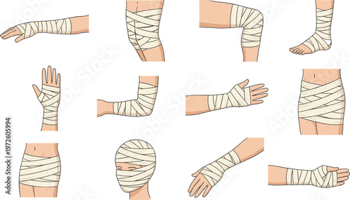 Vector illustration of medical bandaging techniques for forearm, knee, ankle, wrist, hand, elbow, thigh, head and torso