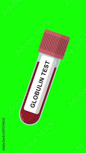 Globulin Blood Test Tube Animation on Green Screen Background, Protein Level Test, Liver Function Test, Medical Lab Sample, Healthcare Laboratory Concept