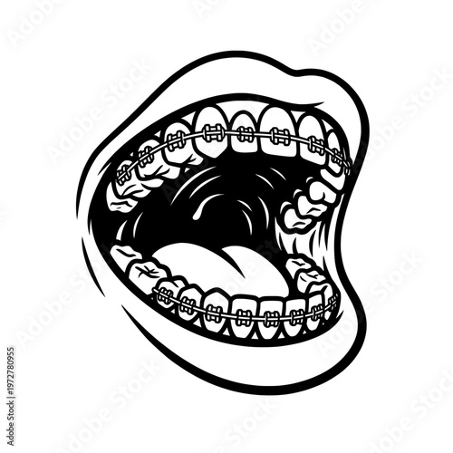 open mouth with braces line drawing illustration vector clipart black and white