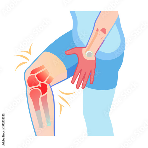 Man with knee pain, joint inflammation, bone health, medical illustration