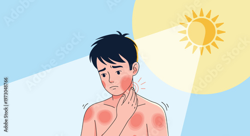 Young man suffering from painful red sunburn on his neck and shoulders after spending too much time under the hot sun.