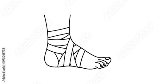 Line drawing of a foot and ankle wrapped in a bandage