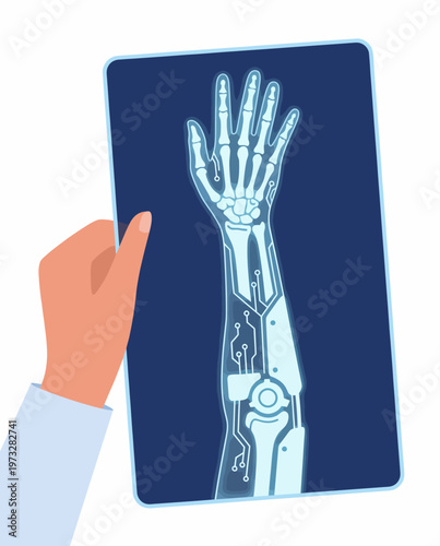 A detailed depiction of a robotic arm X-ray with circuit patterns, illustrating the integration of technology and innovation in modern engineering and futuristic design.