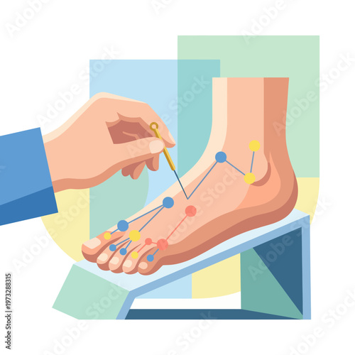 A hand applies acupuncture on a human foot, displaying points on a diagram, illustrating the intersection of holistic health practices and alternative medical treatments.