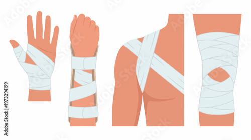 Canvas-taulu This image features various views of a hand and arm being bandaged, demonstrating proper bandaging techniques crucial for injury care and recovery